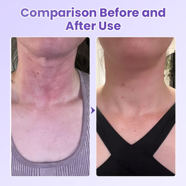 AuraLift Neck Patch - A Youthful, Sculpted Neck + 50% OFF