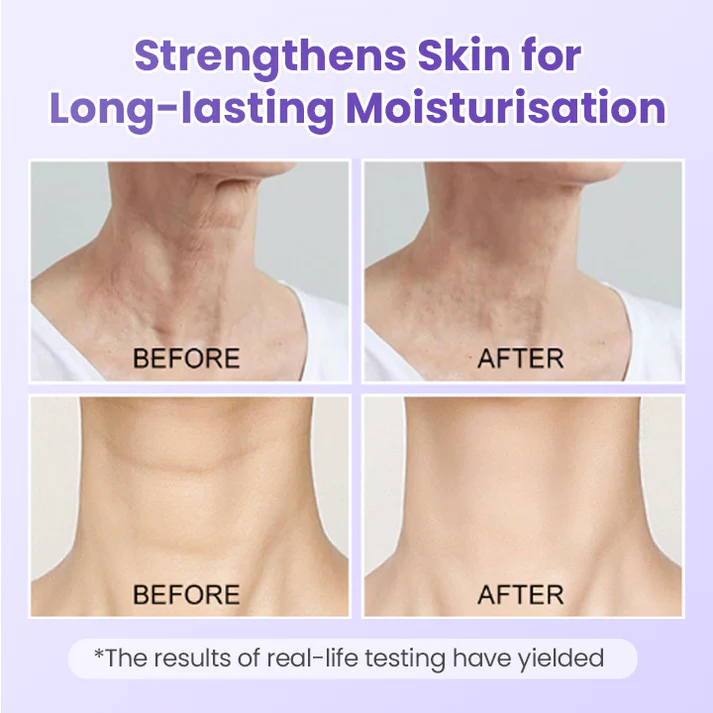 AuraLift Neck Patch - A Youthful, Sculpted Neck + 50% OFF