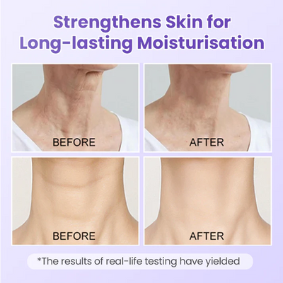 AuraLift Neck Patch - A Youthful, Sculpted Neck + 50% OFF