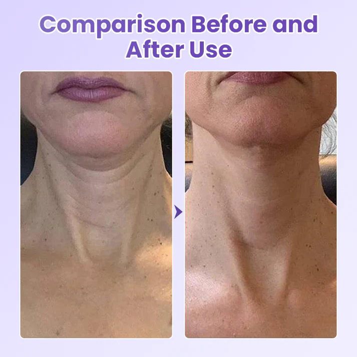 AuraLift Neck Patch - A Youthful, Sculpted Neck + 50% OFF