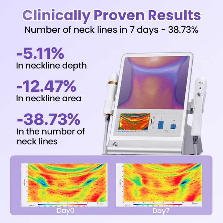 AuraLift Neck Patch - A Youthful, Sculpted Neck + 50% OFF
