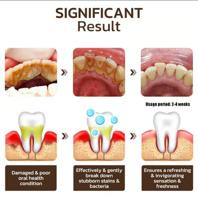 DentaBright Niacinamide Elixir - Reclaim Your Dazzling Smile & Unshakeable Confidence - 50% OFF
