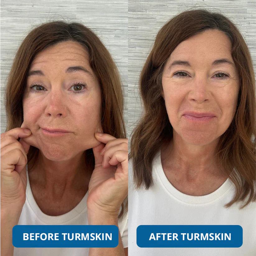 The TurmSkin Ultra Hydrating Serum - A Youthful Glow, Without the Clinic + 50% OFF