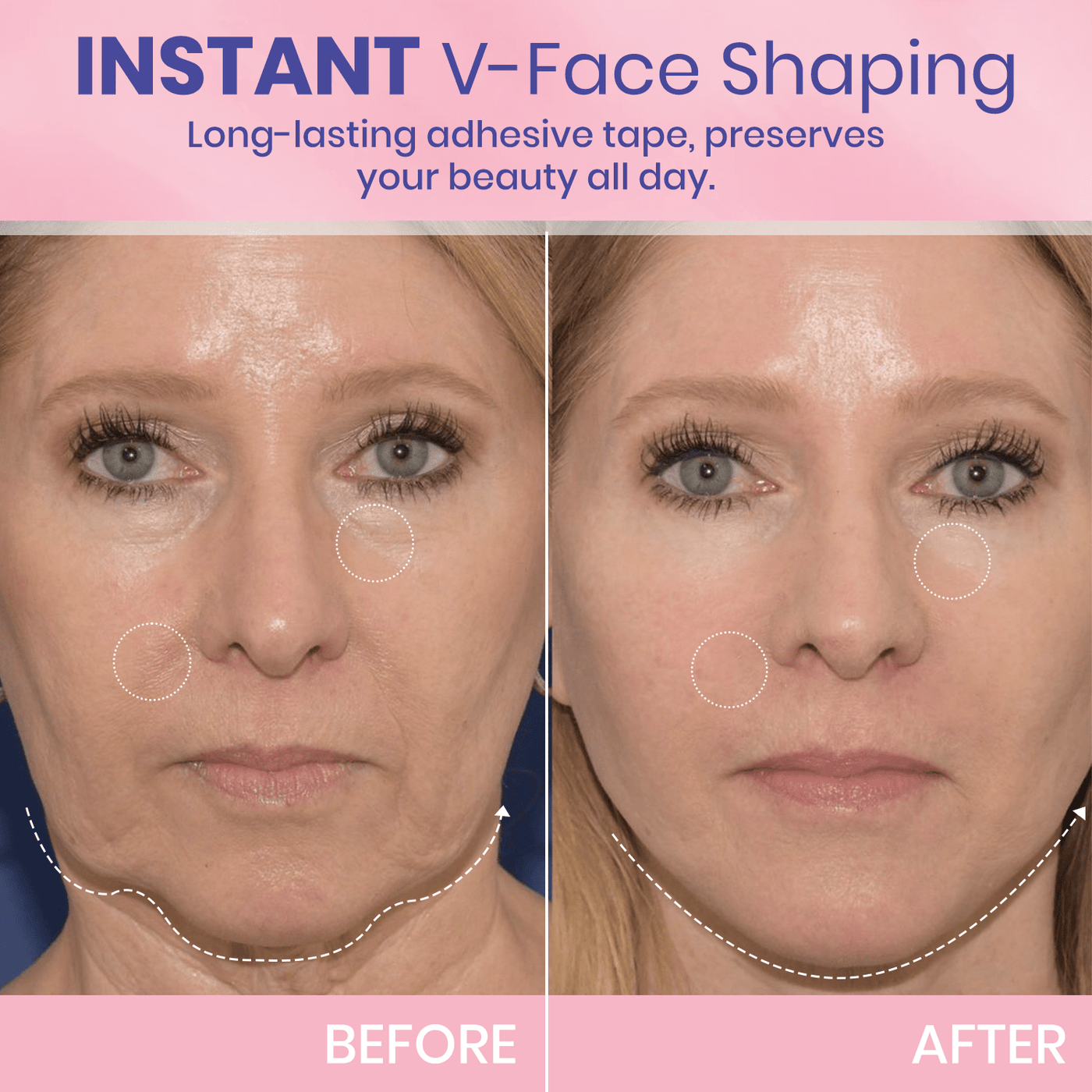 Instant V-Lift Tape – Lift Years Off Instantly! - 60% OFF