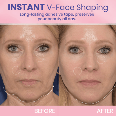 Instant V-Lift Tape – Lift Years Off Instantly! - 60% OFF