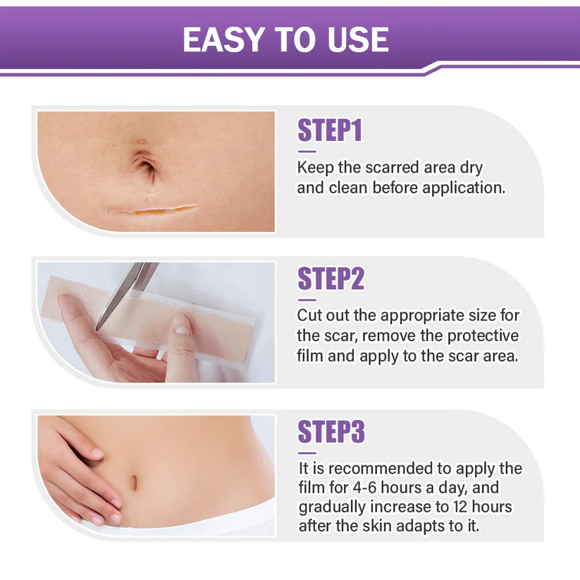 DermalCore Nano-Repair Tape - Erase Scars At The Root - 50% OFF