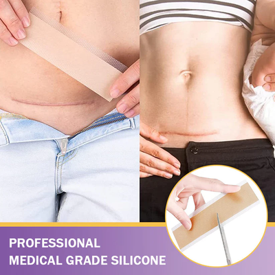 DermalCore Nano-Repair Tape - Erase Scars At The Root - 50% OFF