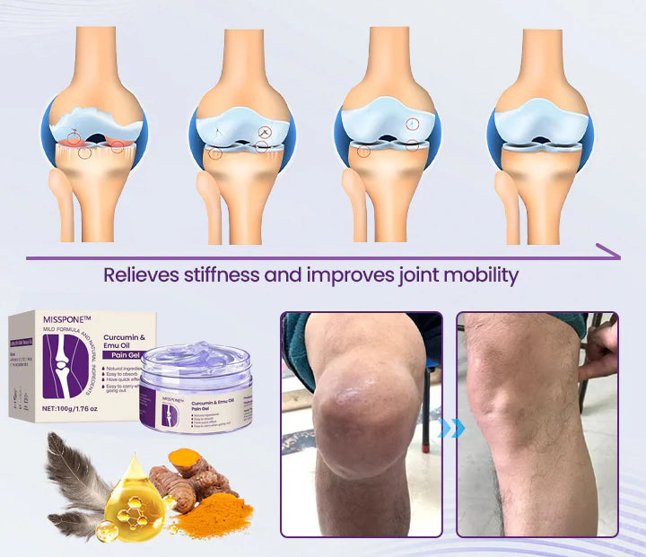 The PainRelief Gel - Soothing Relief, Backed by Experts + 50% OFF