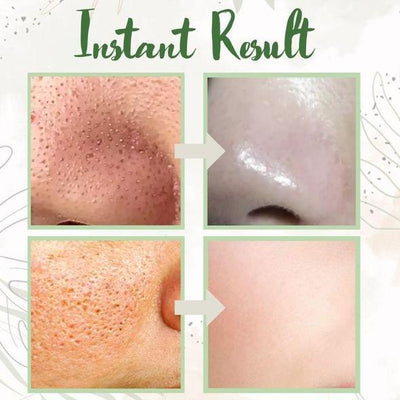 GreenCleanse Stick – Effortlessly Purify Your Skin & Reveal Your Natural Radiance - 50% OFF