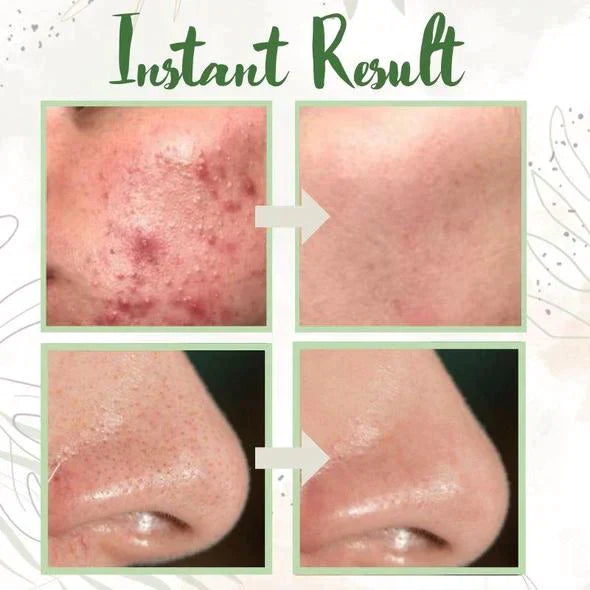 GreenCleanse Stick – Effortlessly Purify Your Skin & Reveal Your Natural Radiance - 50% OFF