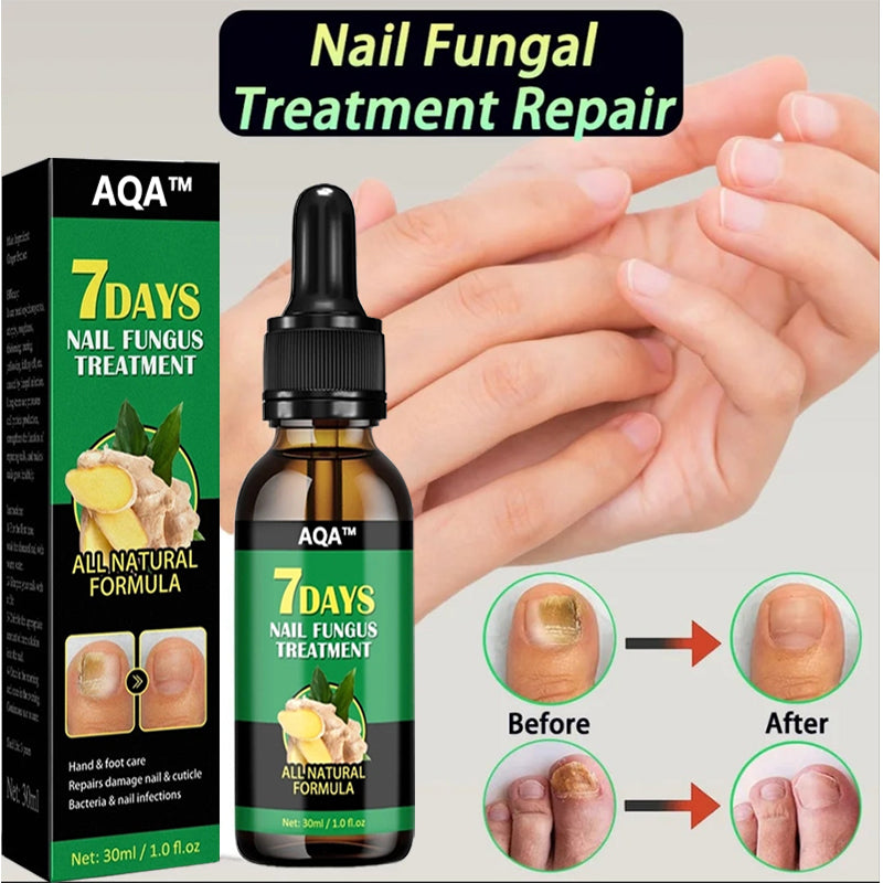 Zingiber Nail - Ginger Nail Treatment Nail