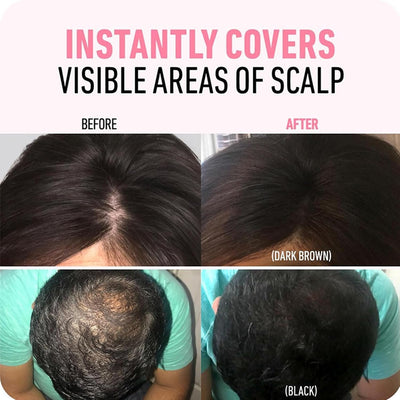 VeriFill Hair Transformer + Reclaim Your Confident, Full-Bodied Look - 50% OFF