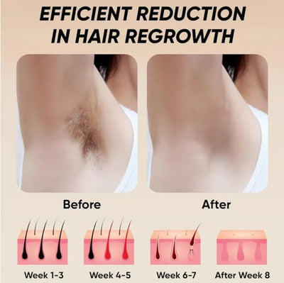 GlowBare IPL Hair Remover – Silky Skin Starts at Home - 50% OFF