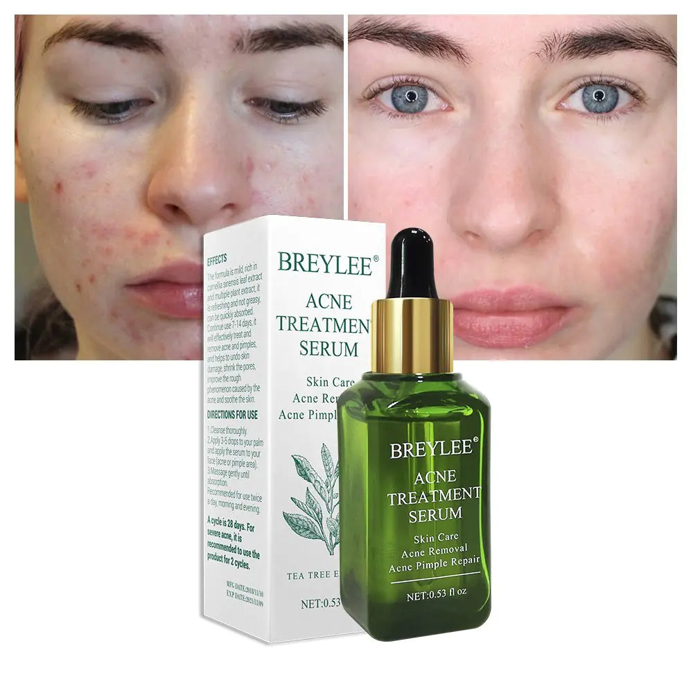 RadiantClear - Achieve Visibly Clearer, Healthier Skin and Reclaim Your Confidence 50 % OFF