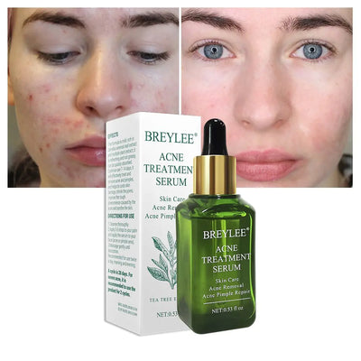 RadiantClear - Achieve Visibly Clearer, Healthier Skin and Reclaim Your Confidence 50 % OFF