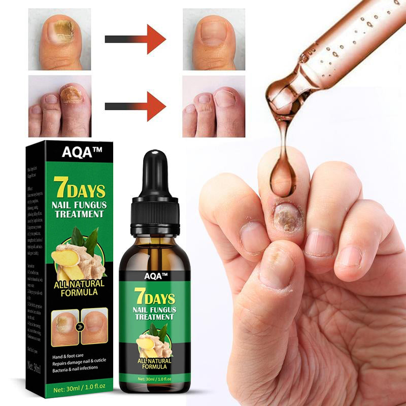 Zingiber Nail - Ginger Nail Treatment Nail