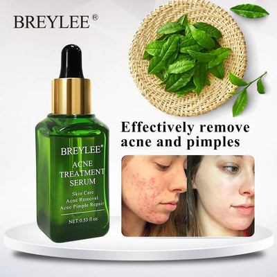 RadiantClear - Achieve Visibly Clearer, Healthier Skin and Reclaim Your Confidence 50 % OFF