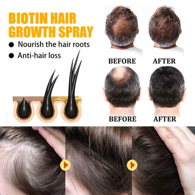 LushLocks Hair Growth Spray – Nourish, Strengthen, Grow - 1 + 1 FREE