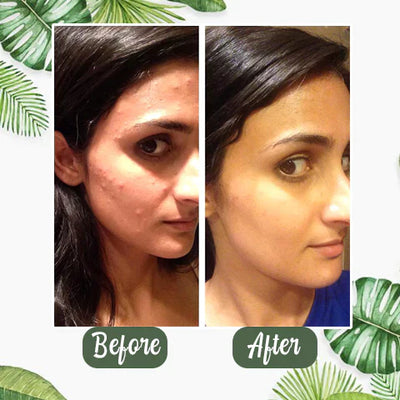GreenCleanse Stick – Effortlessly Purify Your Skin & Reveal Your Natural Radiance - 50% OFF