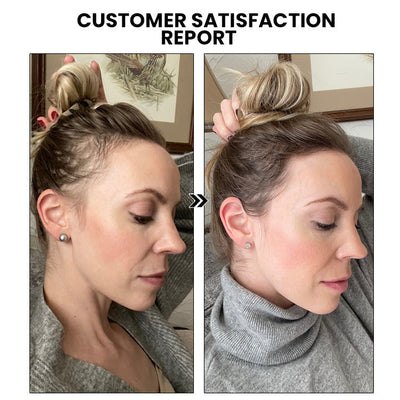 HairRevive – Unlock Your Hair’s Full Potential - 1+1 FREE