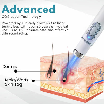 DermaZap - Flawless Skin, No Scars, No Surgery - 50% OFF