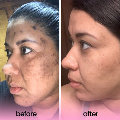 Clarity Glow Pads – Unveil Brighter, Even, Clear Skin - 60% OFF