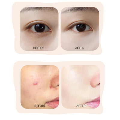 FlawlessRenew 2-in-1 Concealer – Reveal Your Radiant, Ageless Beauty - 1+1 FREE