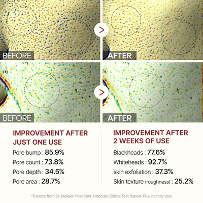 ChronoGlow Serum - Your "Glass Skin" in a Bottle - 50% OFF