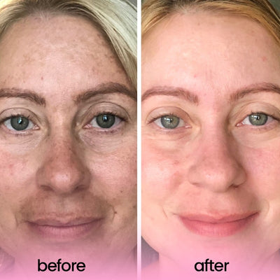 Clarity Glow Pads – Unveil Brighter, Even, Clear Skin - 60% OFF